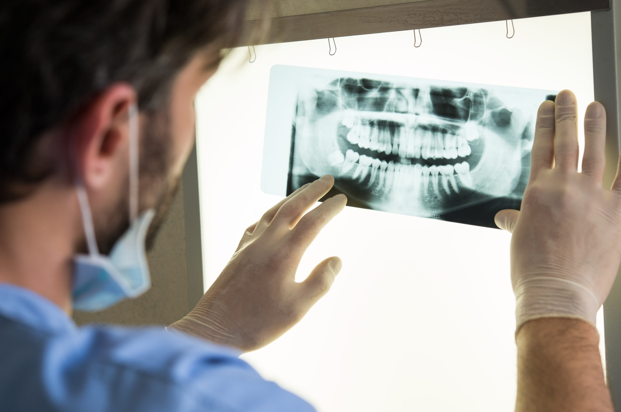A dentist reviewing digital X-rays on screen