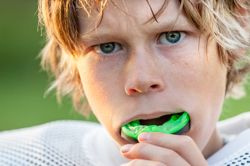 A custom sports mouthguard