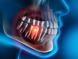 emergency-tooth-pain