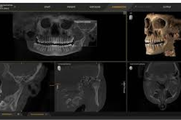 A 3D scan shown on screen