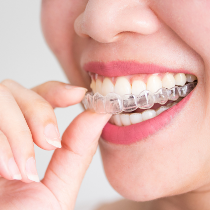 Cosmetic dentistry and Invisalign