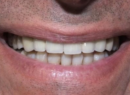 Patient after treatment