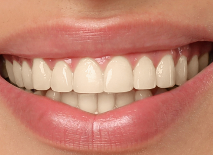 Before treatment