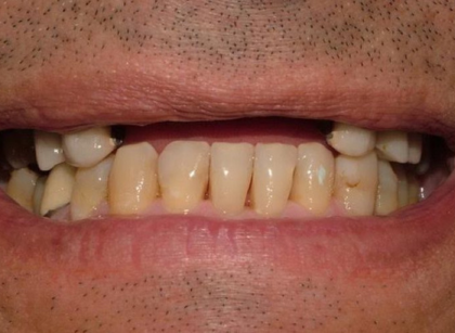 Patient before treatment
