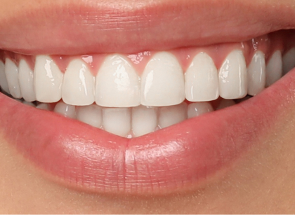 After treatment