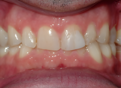 Patient before treatment