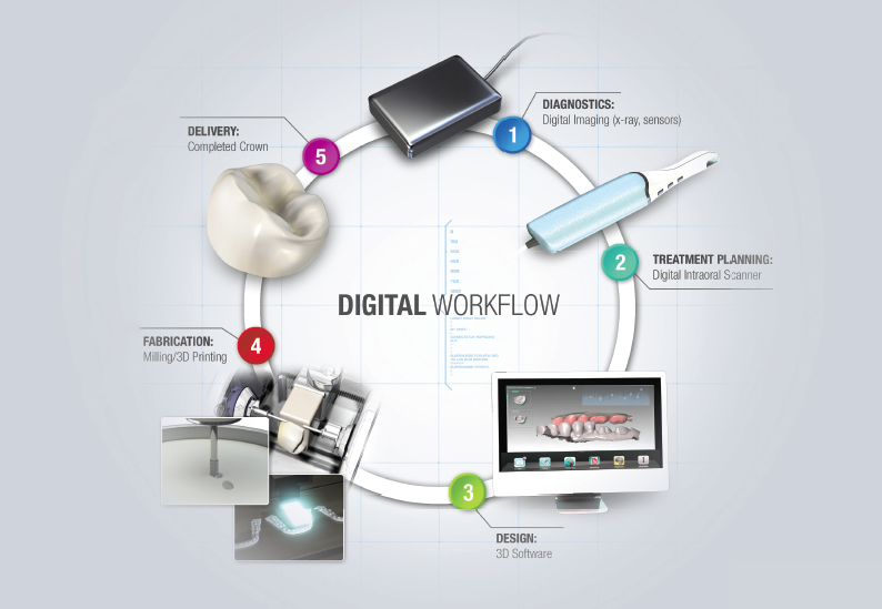 Diagram of the connected digital workflow from scan to restoration